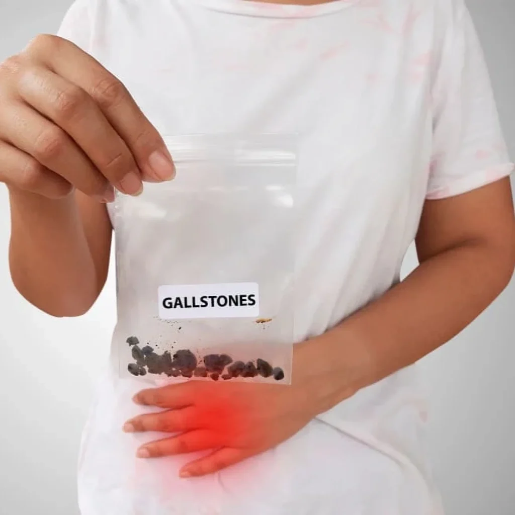 Gallbladder Stone Treatment in Jaipur